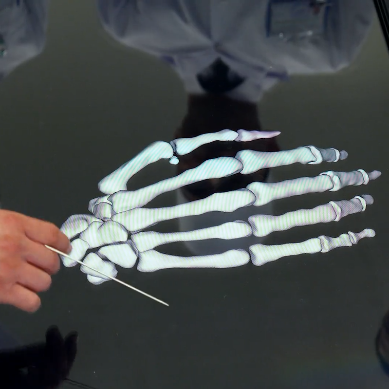 Eliň skeletiniň s&uuml;ňleri we olaryň gurluşy. Anatomage 3D enjamynda amaly sapak